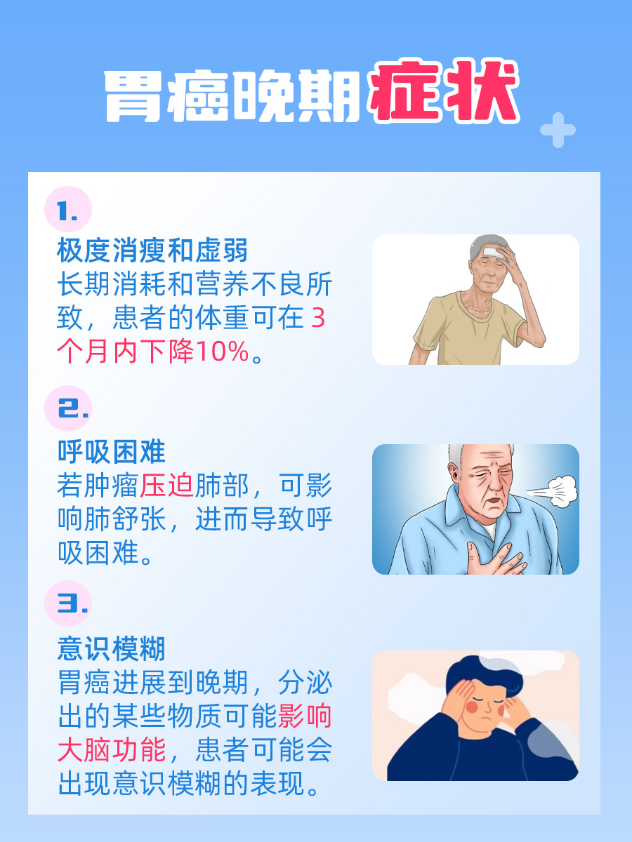 胃癌晚期患者临终前三天的预警征兆