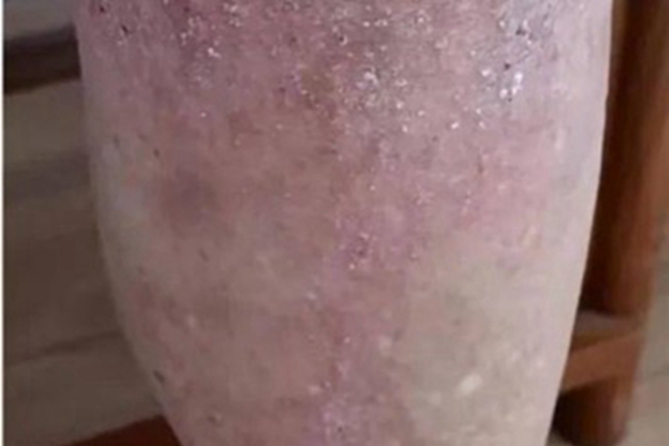 干性湿疹小腿有白色脱屑图