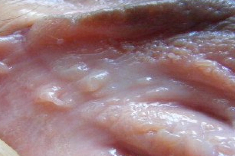 女性生殖器疱疹图