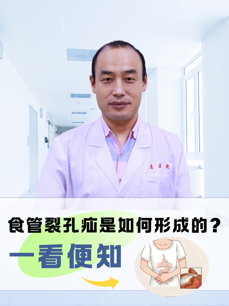 食管裂孔疝是如何形成的？一看便知