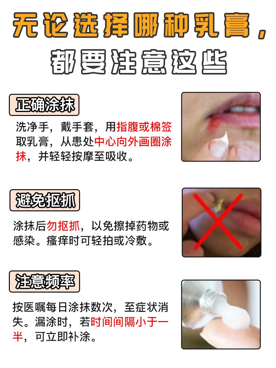 阿昔洛韦乳膏VS喷昔洛韦乳膏，你选对了吗？