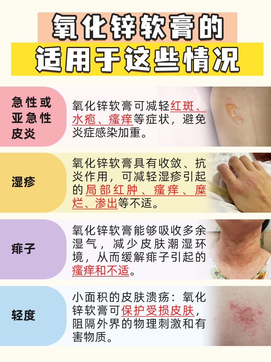 孕妇疑问：氧化锌软膏能否安心用？