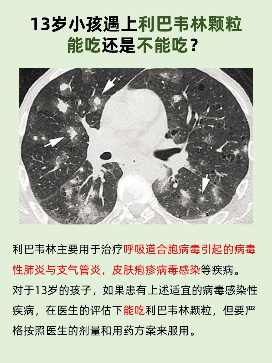 家长必看!13岁小孩能否吃利巴韦林颗粒?