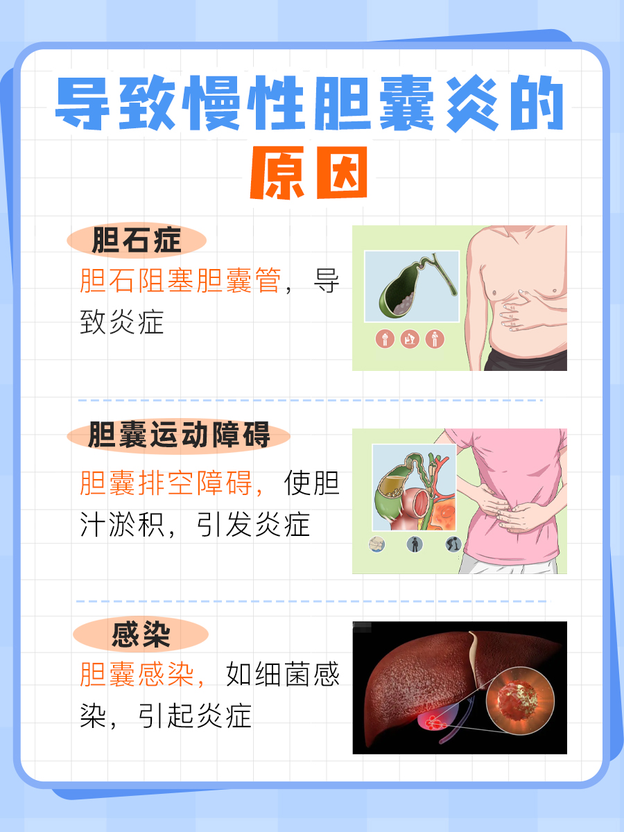 慢性胆囊炎的“22个症状”？你中了吗？