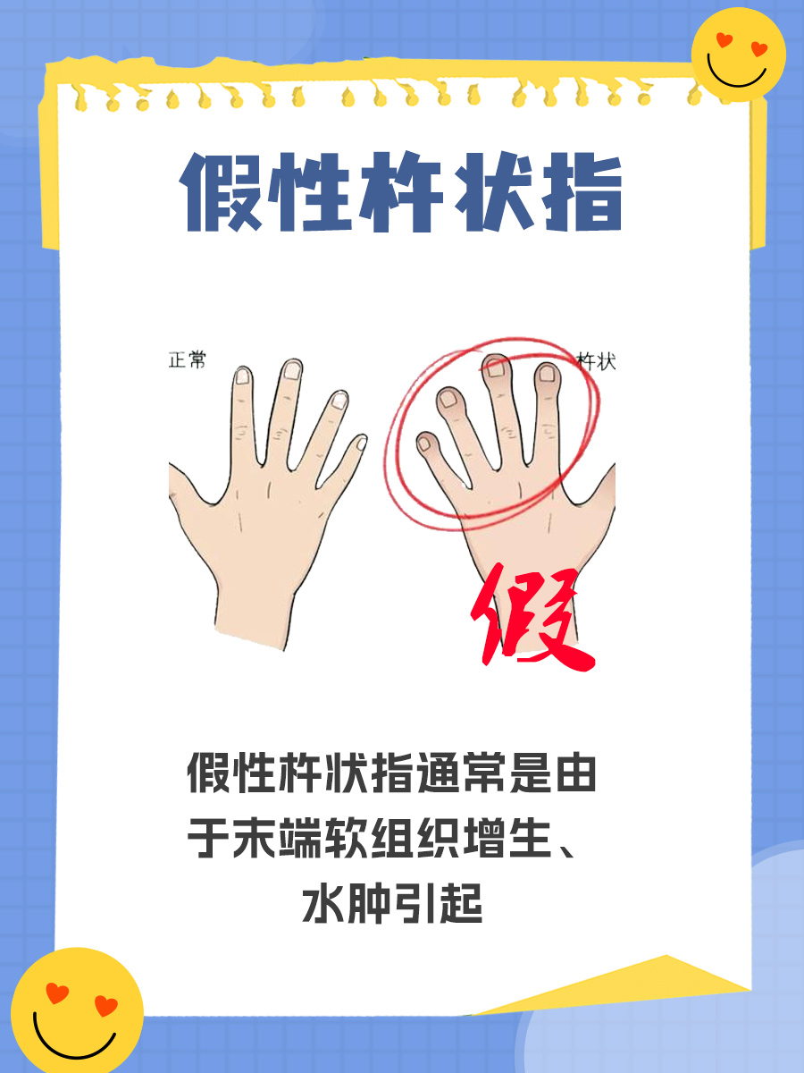 揭秘假性杵状指，别让手指变形吓到你！