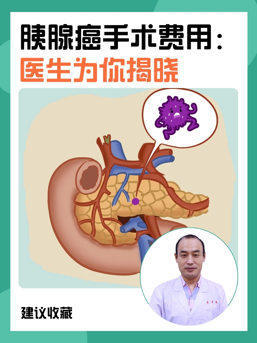 胰腺癌手术费用:医生揭晓!