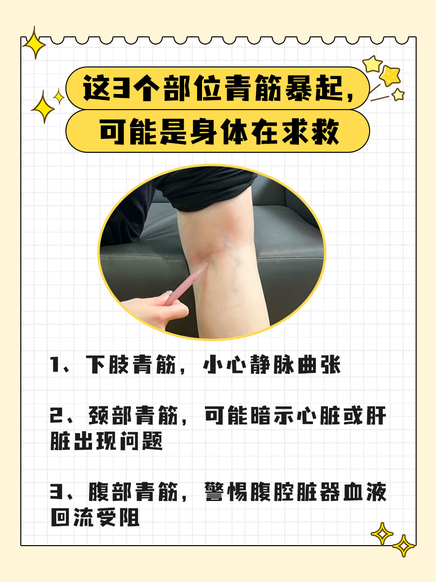 颈部青筋凸起？小心颈静脉怒张！