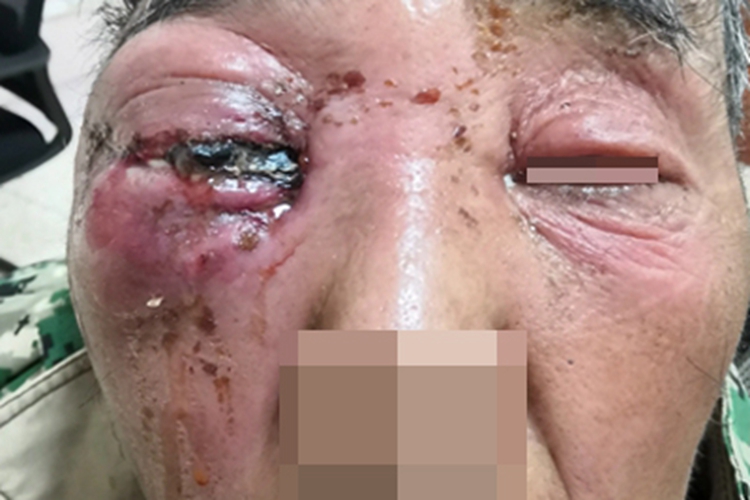 本文由有来医生原创,经专业医师审核校对