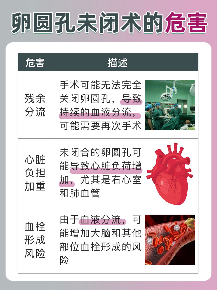 卵圆孔未闭术后如何睡眠：关注术后睡姿