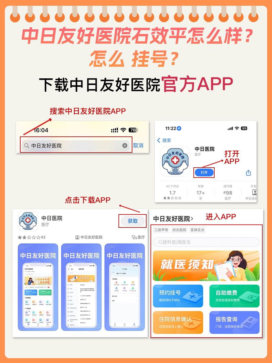 中日友好医院石效平怎么样?怎么挂号?