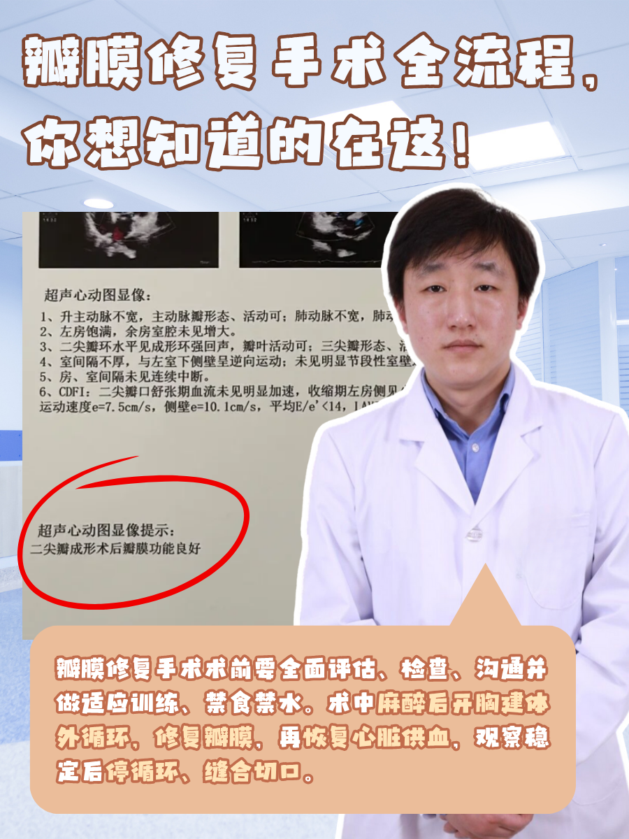 瓣膜修复手术全流程，你想知道的在这！