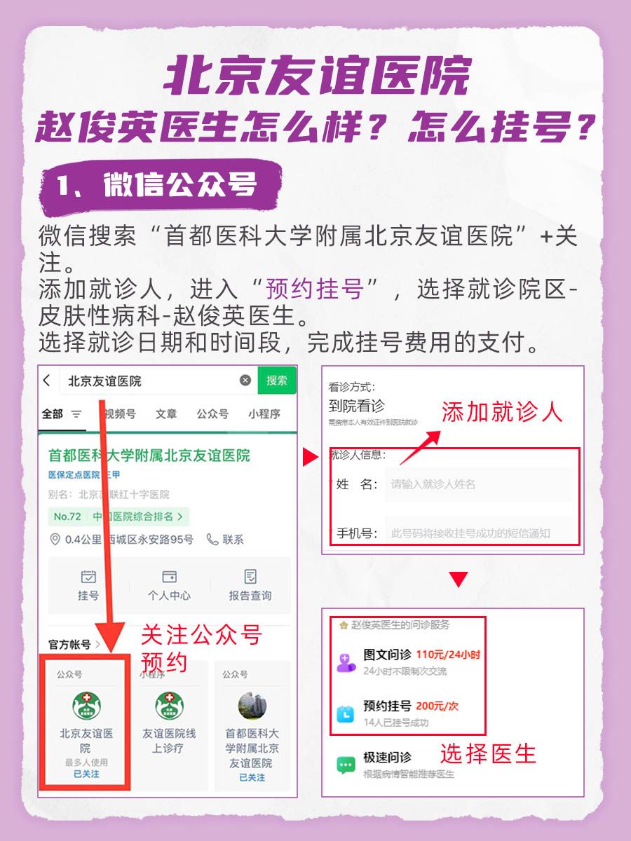 北京友谊医院赵俊英医生怎么样？怎么挂号？