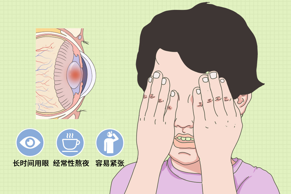 治疗周期: 长期间歇性治疗 临床症状: 远视物正常,近视物模糊,眼睛