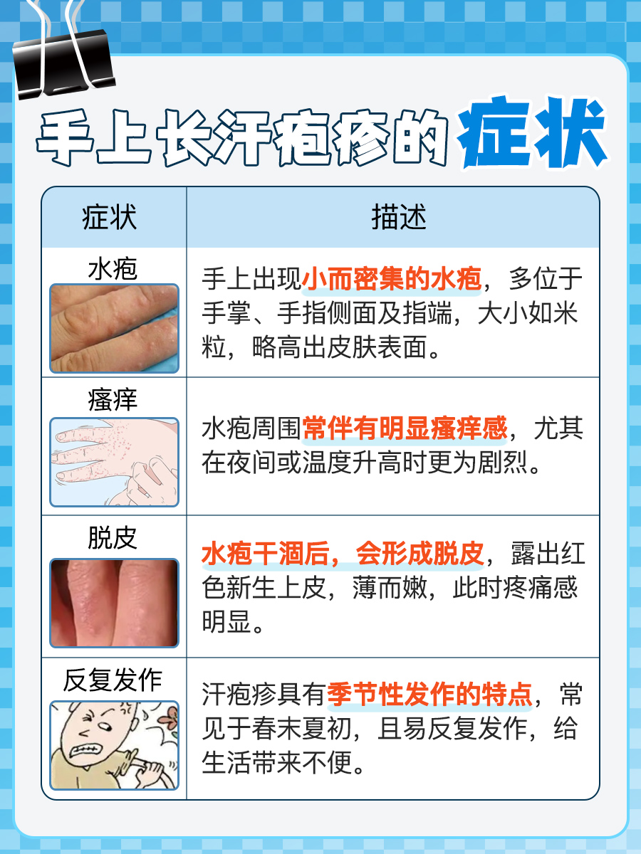 告别手上汗疱疹，药膏使用攻略