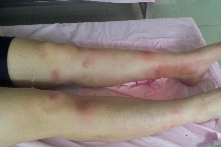 热毒壅聚无名肿毒红肿图