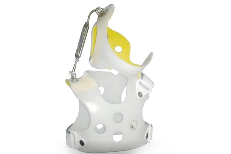 固定式胸椎支具矫形器图