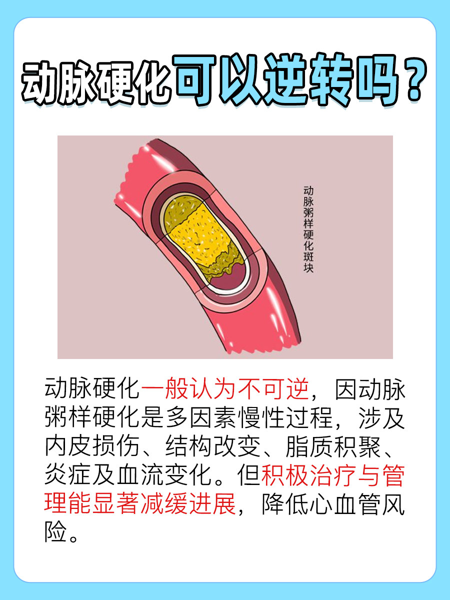 动脉硬化有没有逆转的可能？