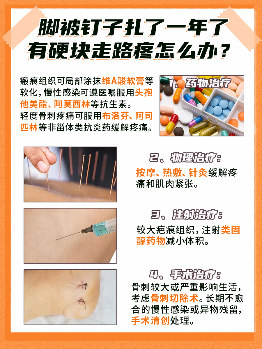 钉子扎脚一年后硬块疼？我来支招！