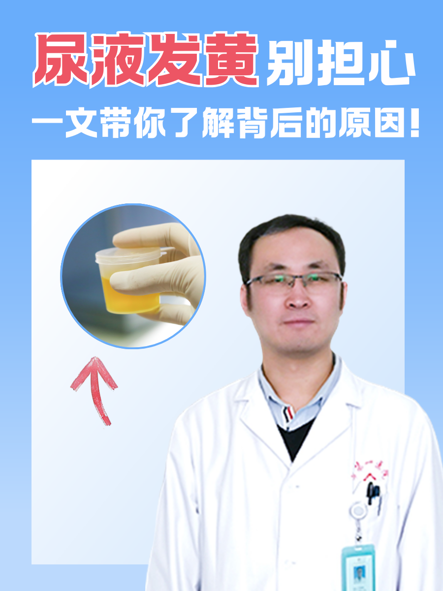 尿液发黄别担心，一文带你了解背后的原因！