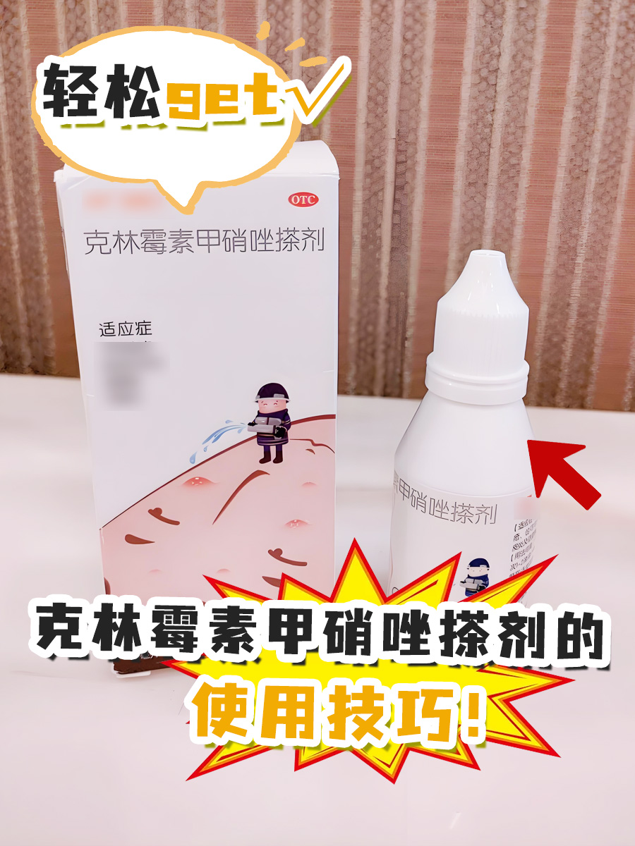 轻松get√ 克林霉素甲硝唑搽剂的使用技巧！