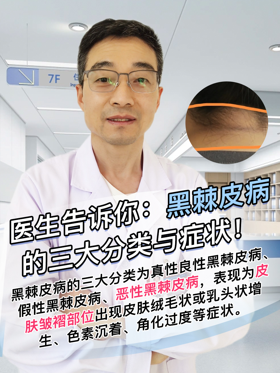医生告诉你:黑棘皮病的三大分类与典型症状!