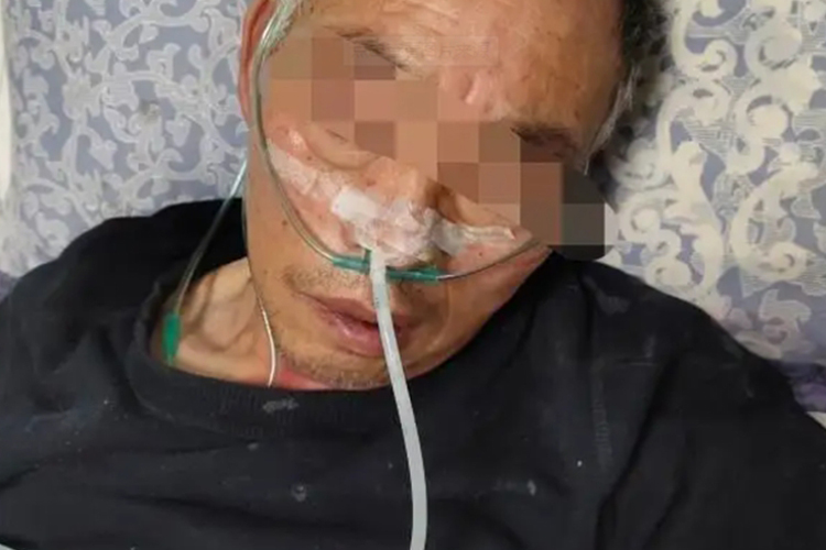 脑梗致吞咽困难后遗症图 脑梗致吞咽困难后遗症图