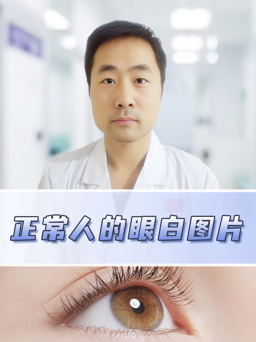 正常人的眼白图片