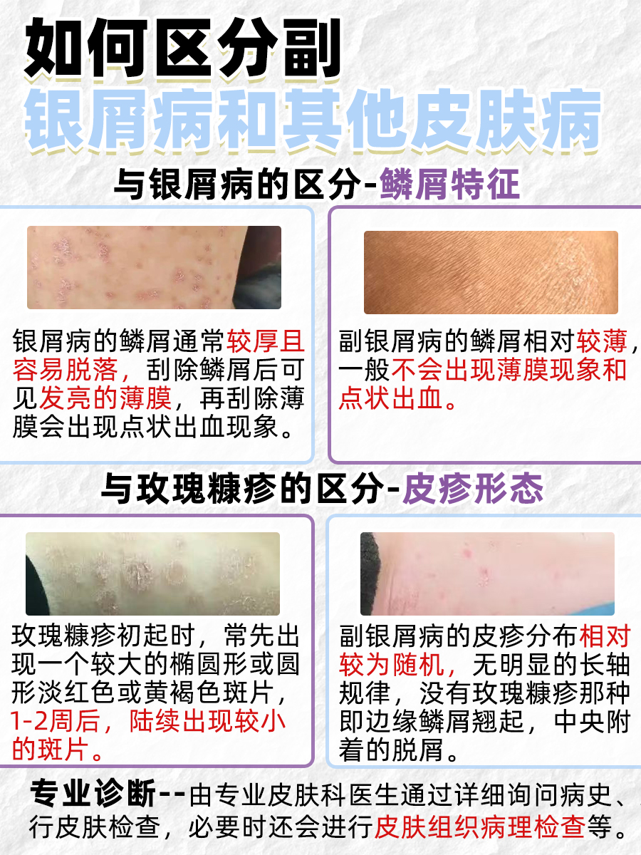 速存！手把手教你识别副银屑病特征