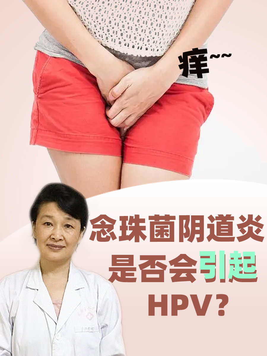 念珠菌阴道炎，是否会引起HPV？