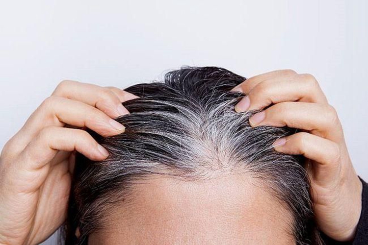 肾虚发白早脱图 肾虚发白早脱图