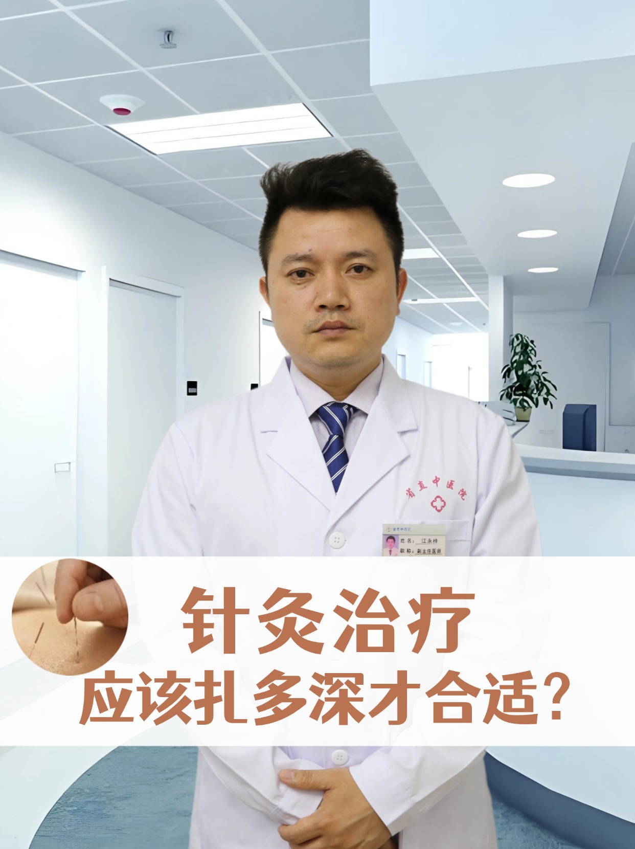 针灸治疗：应该扎多深才合适？