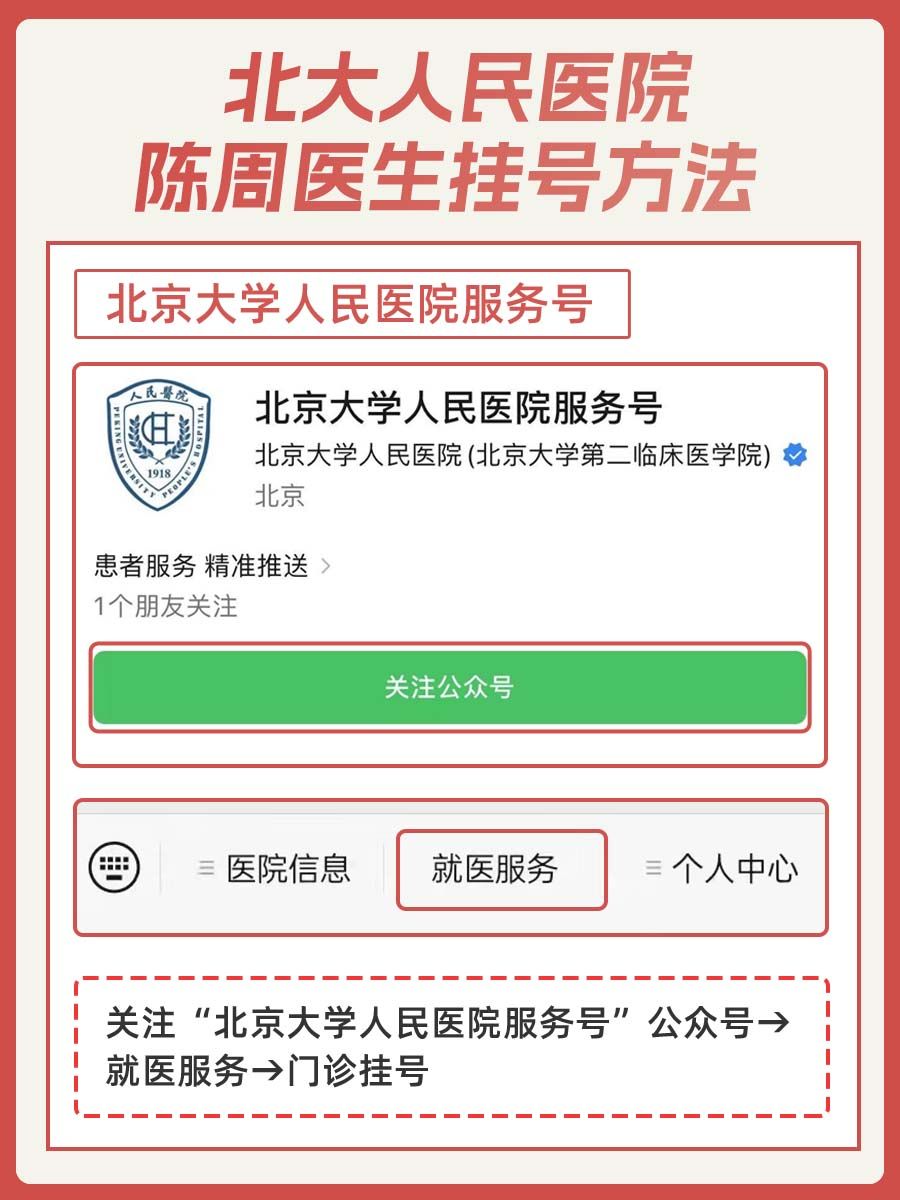 北大人民医院陈周医生怎么样?怎么挂号?