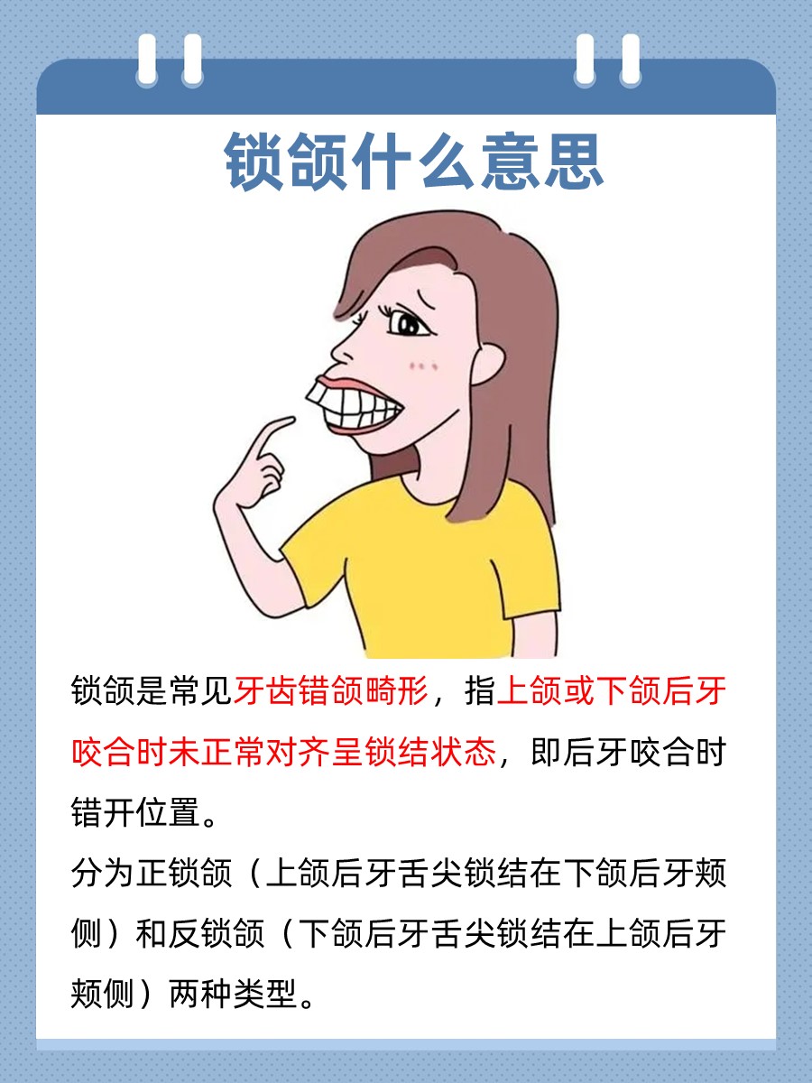 揭秘！锁颌到底什么意思？