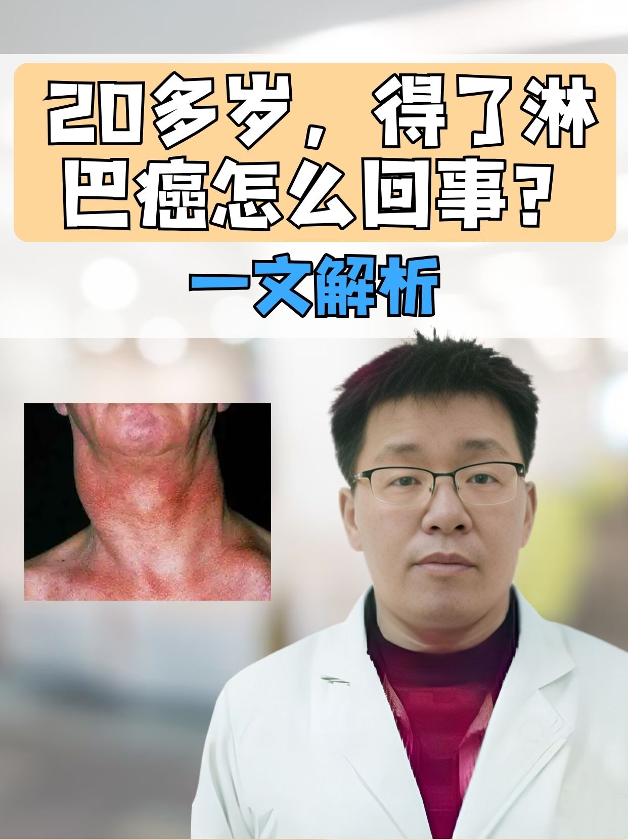 20多岁,得了淋巴癌怎么回事?一文解析