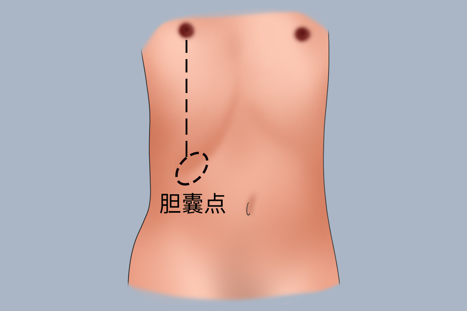 胆囊疼反射区图