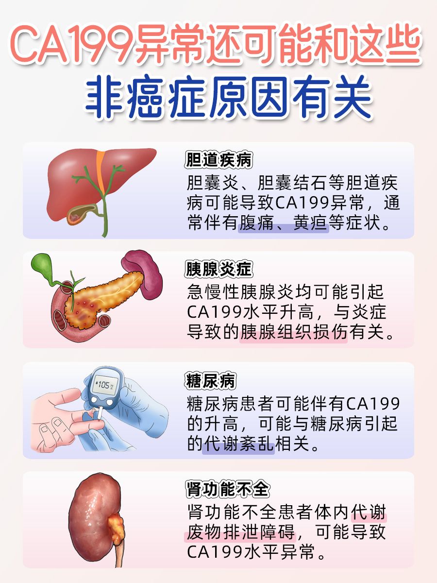 CA199：这个关键肿瘤指标你了解几分？
