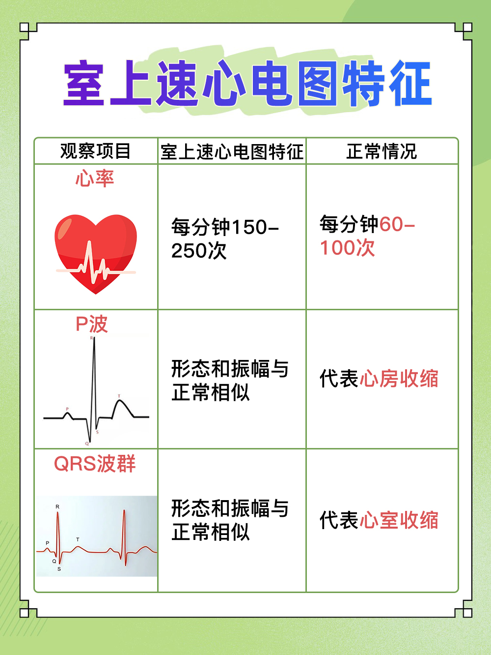 室上速心电图特征，快速识别心律失常！
