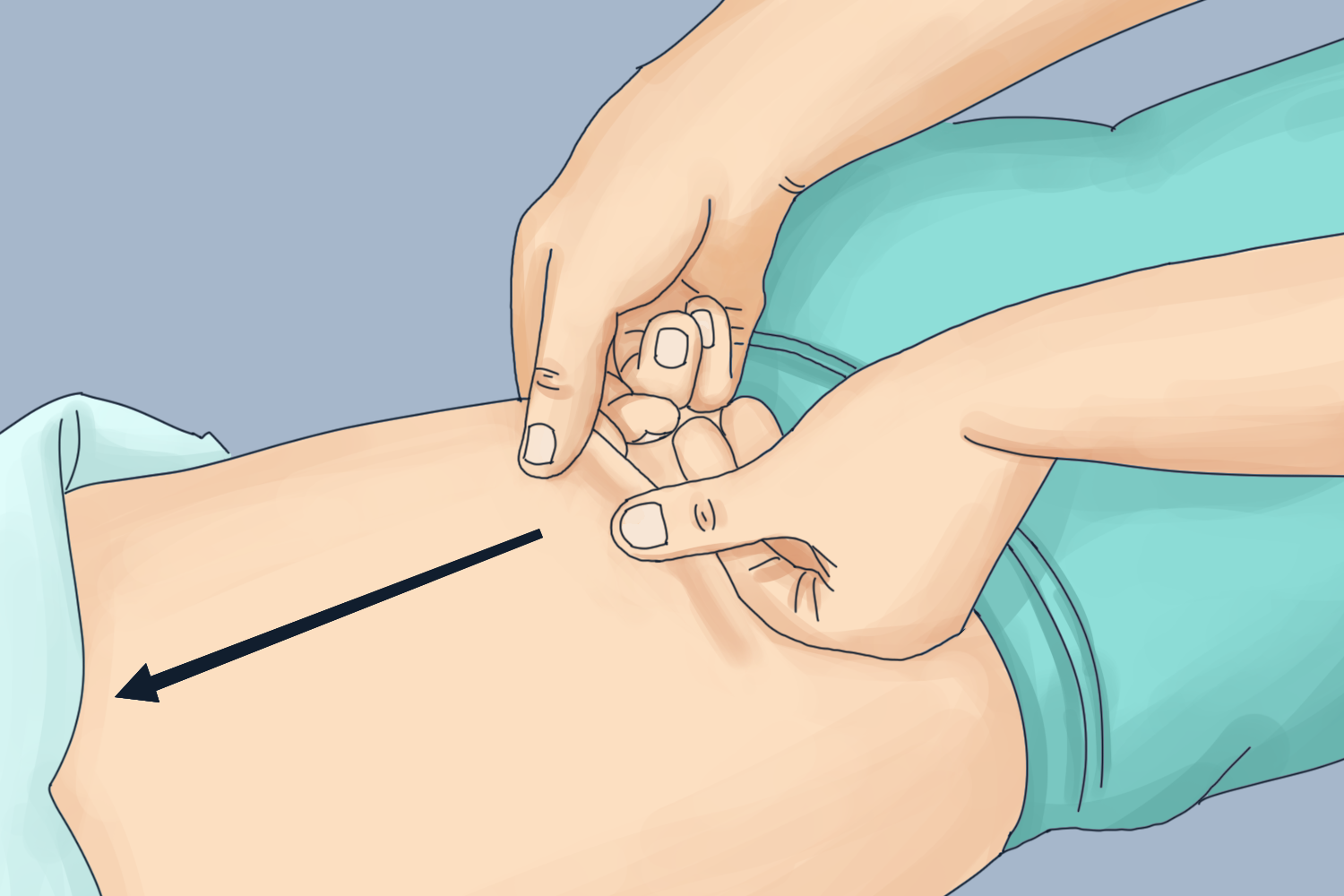 二指捏脊法退烧图 二指捏脊法退烧图