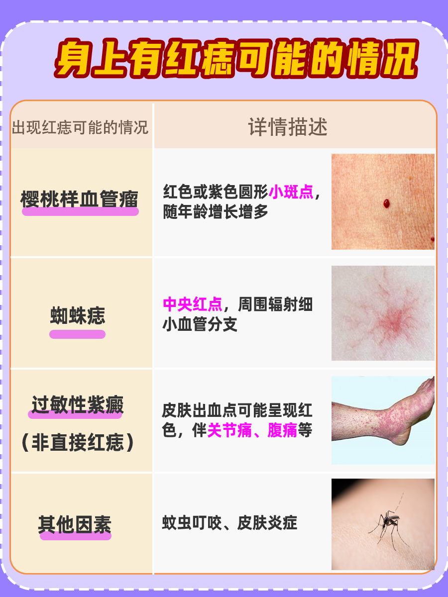 身上有红痣是什么情况?一文解答