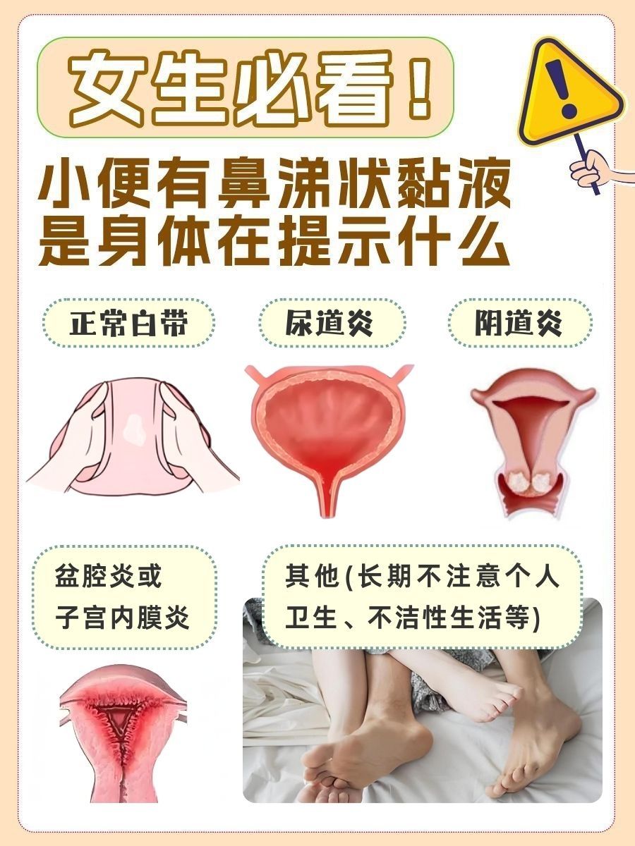 女生必看!小便有鼻涕状黏液,是身体在提示什么