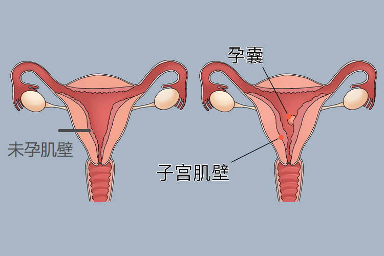 宫颈组织结构分层图片