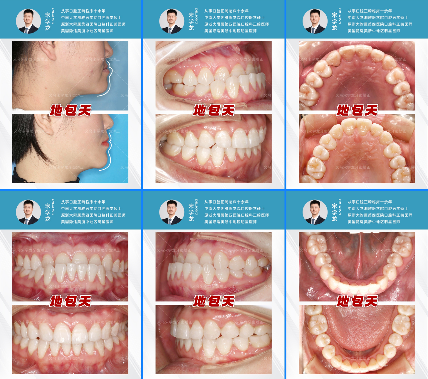 c9f07d42-d9c3-48a0-b4dc-2845af975db9.png