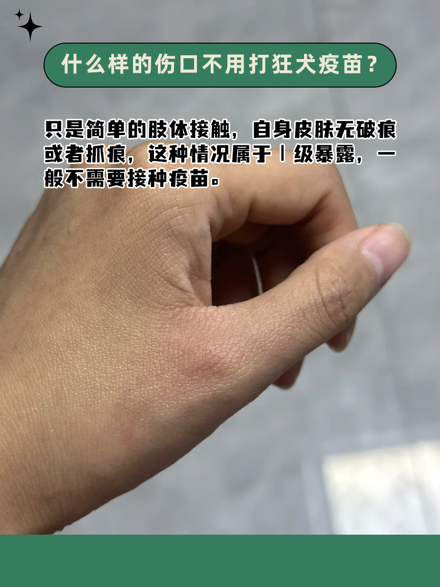 小常识：狂犬病毒暴露在空气中多久死亡