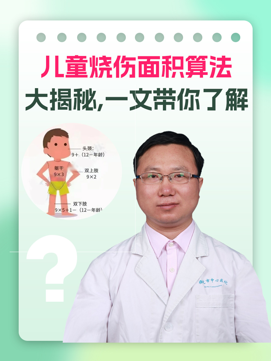 儿童烧伤面积算法大揭秘,一文带你了解!