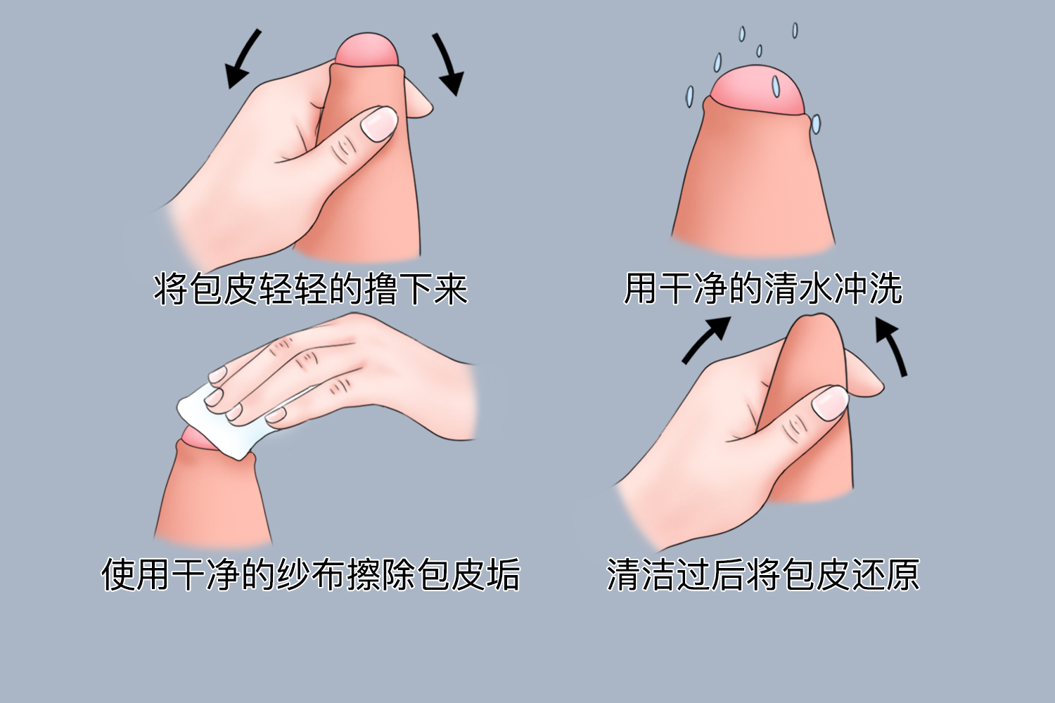 翻包茎的正确方法图