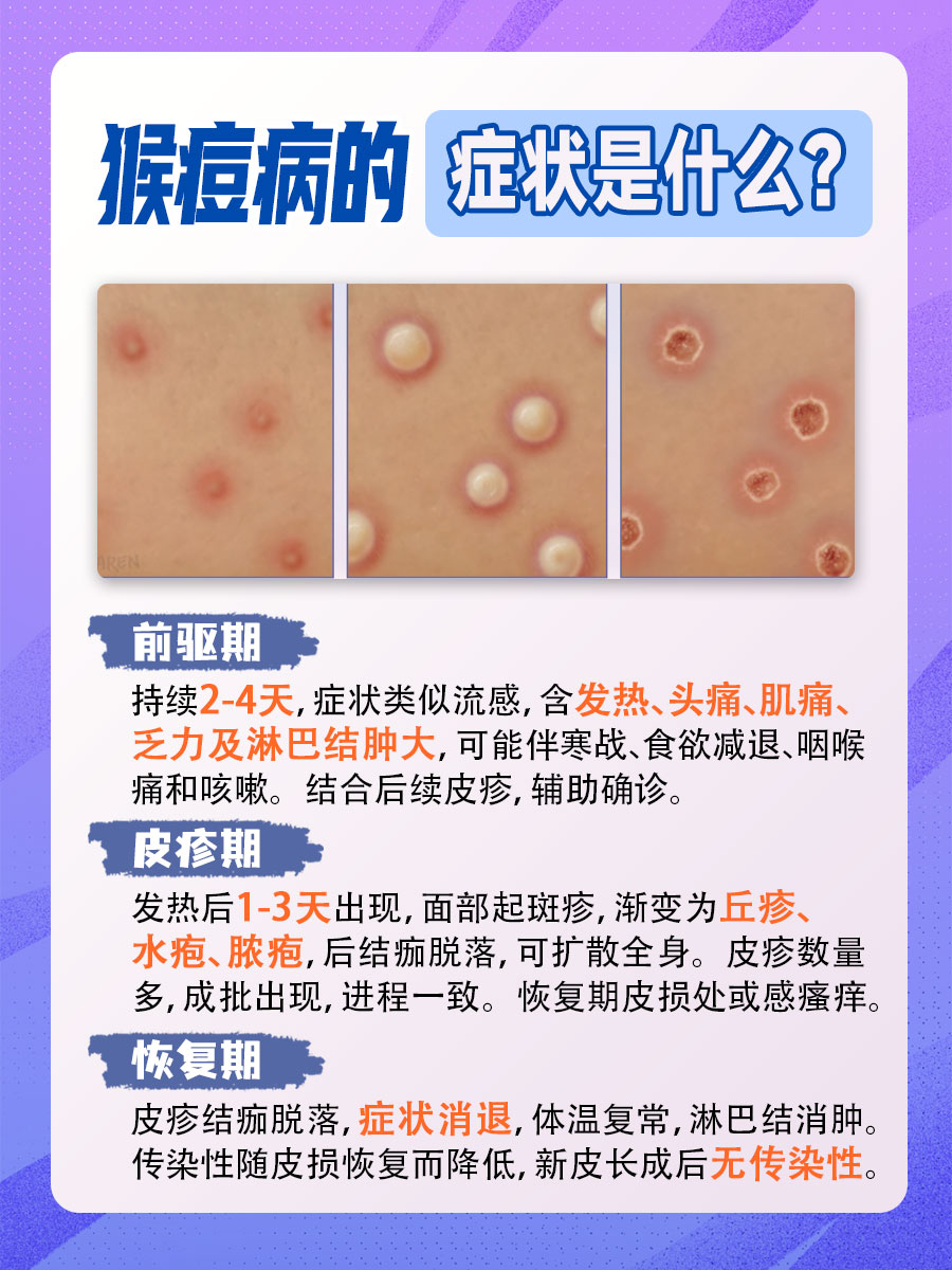 痒？痛？猴痘病的症状是什么？