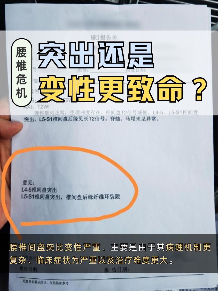 腰椎危机！突出还是变性更致命？