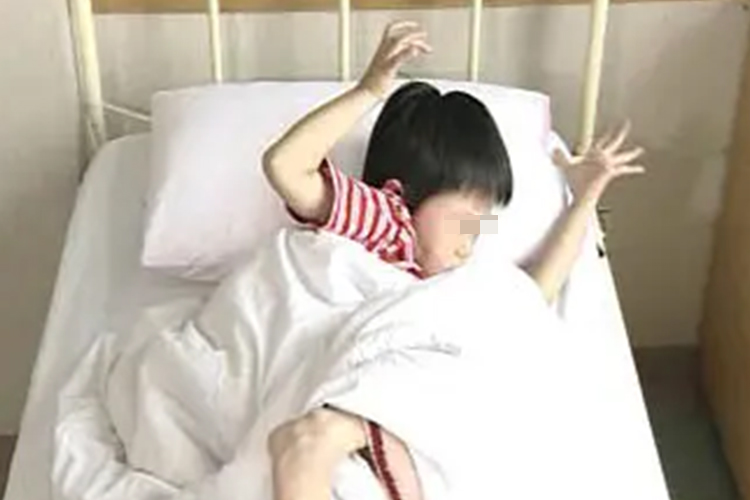 癫痫全身强直-阵挛性发作图 癫痫全身强直-阵挛性发作图