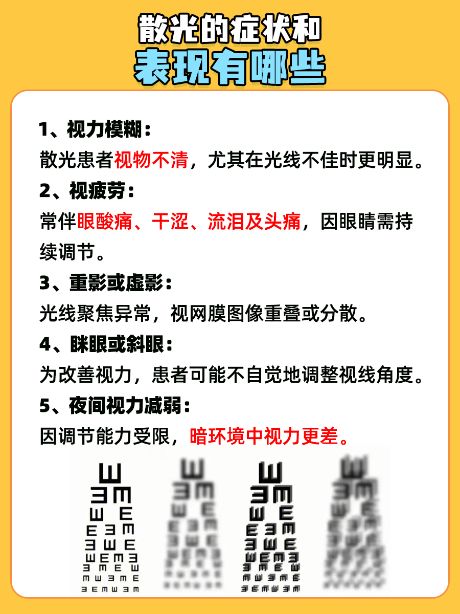 散光的症状和表现有哪些，你知道吗