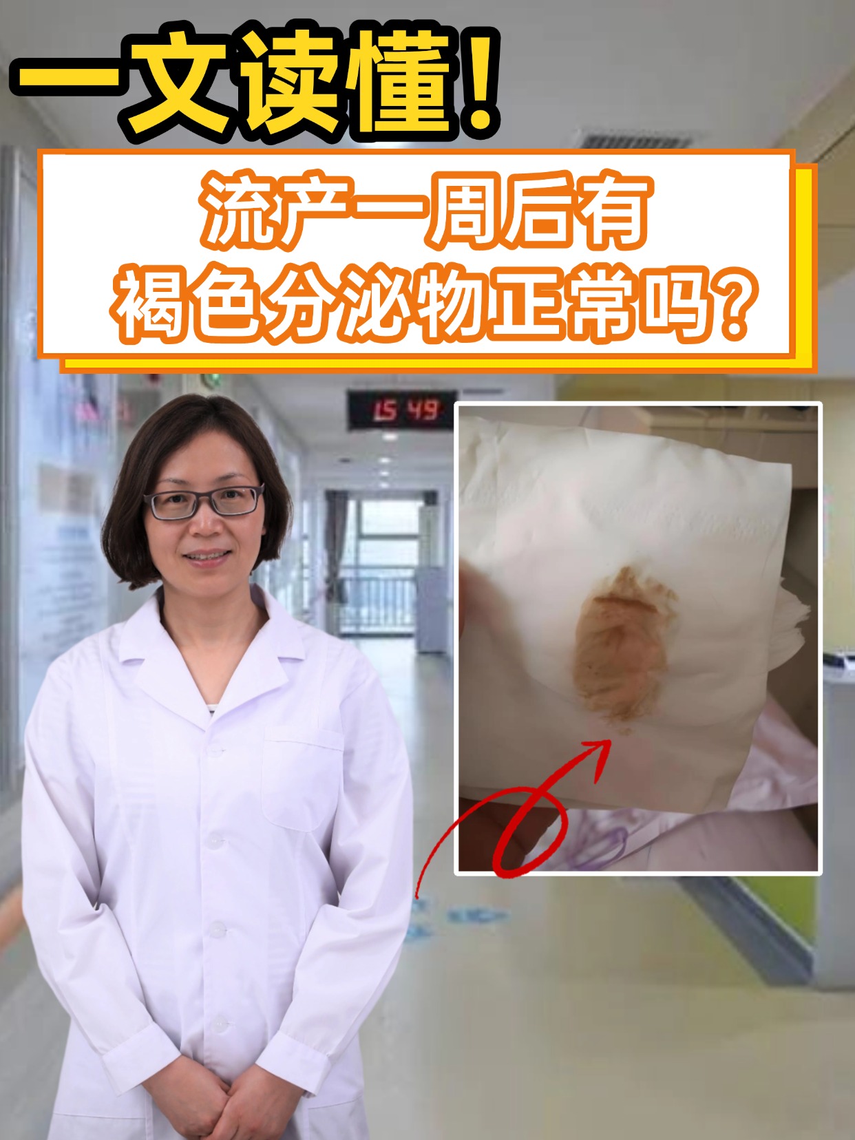 一文读懂！流产一周后有褐色分泌物正常吗？